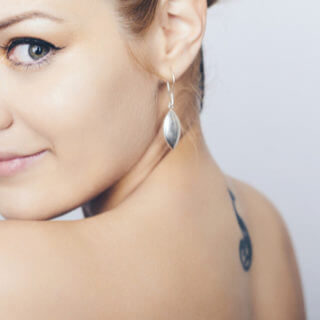 Laser Tattoo Removal Chicago